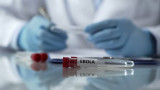 OMS declara emergencia internacional por brote de ébola Bundibugyo