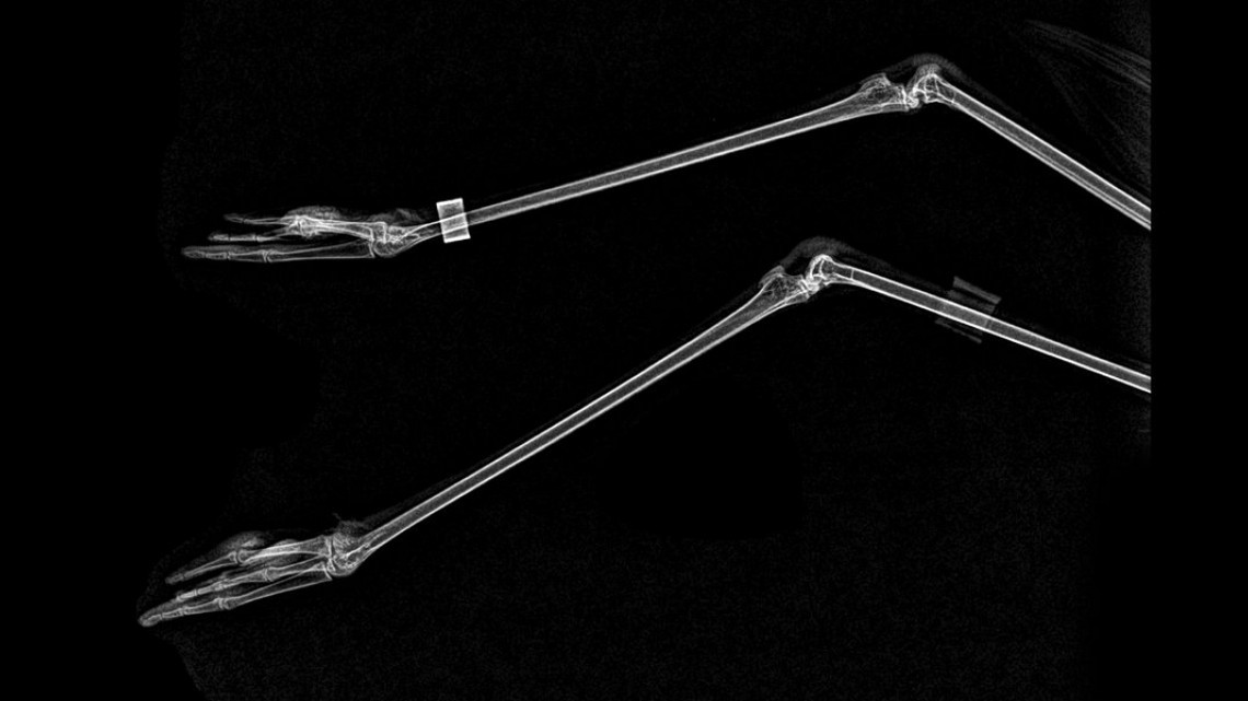 Estas radiografías te dejarán helado