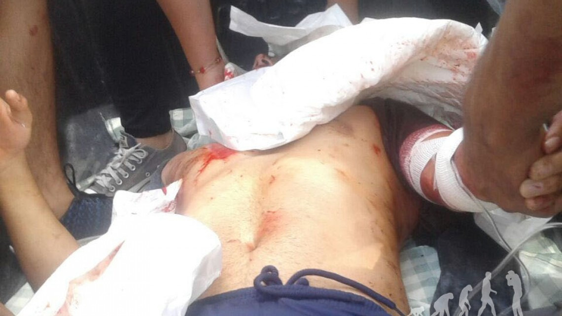 "No fue un disparo como tal", dice Aureoles sobre normalista herido