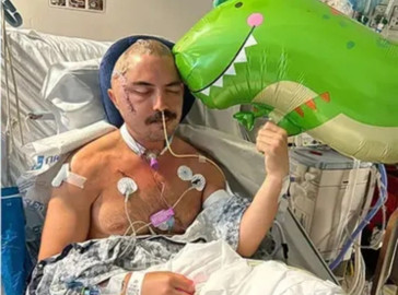 Hombre sobrevive a ataque de caimán 