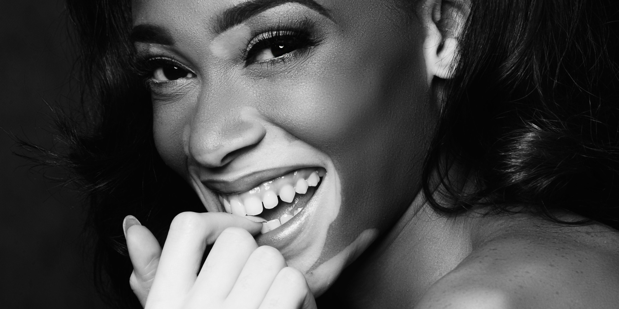 Winnie Harlow es elegida para desfilar en Victoria's Secret