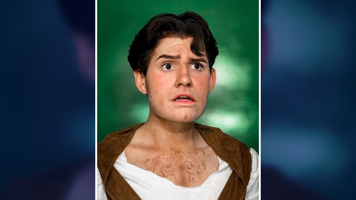 Shrek humano, ¡es real!