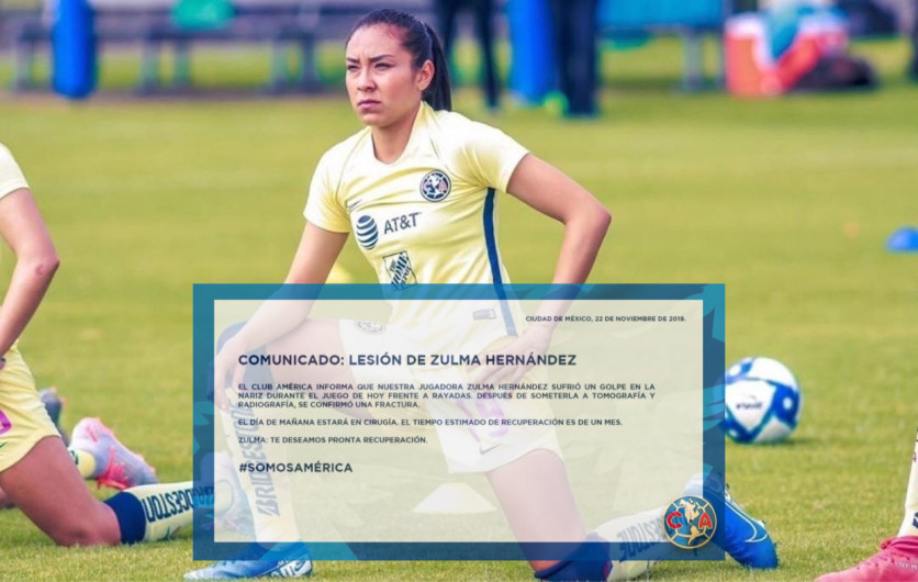 América femenil sufre baja de Zulma Hernández
