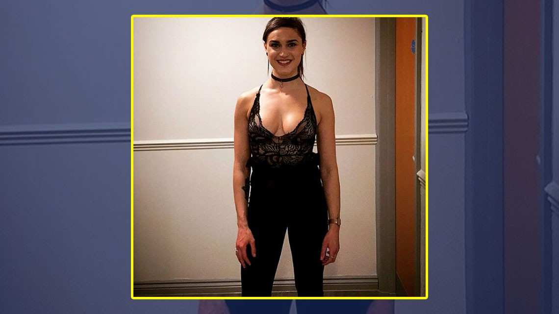 Chica muestra su recuperación tras anorexia