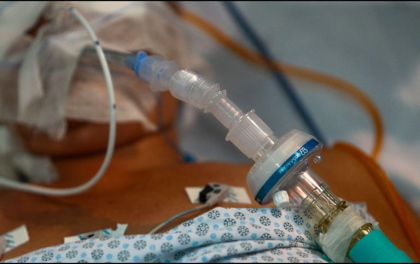 Paciente con Covid-19 mata a otro porque el ruido del respirador le molestaba