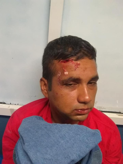 Riñen empleados de espacios públicos 