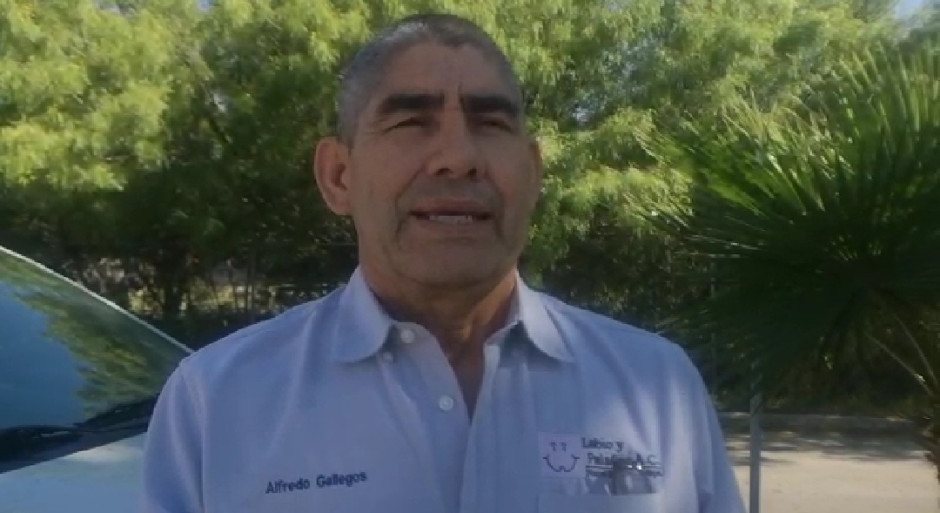 Buscan apoyar niños con labio leporino