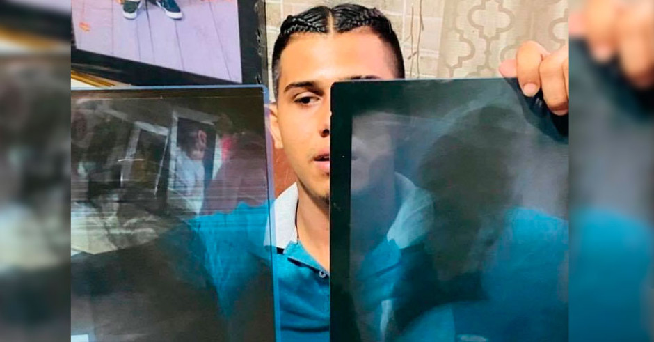 GOPES golpean a joven con cáncer de pulmón