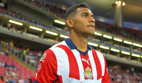 Operan con éxito a Gilberto 'Tiba' Sepúlveda tras su fractura en el duelo ante Toluca