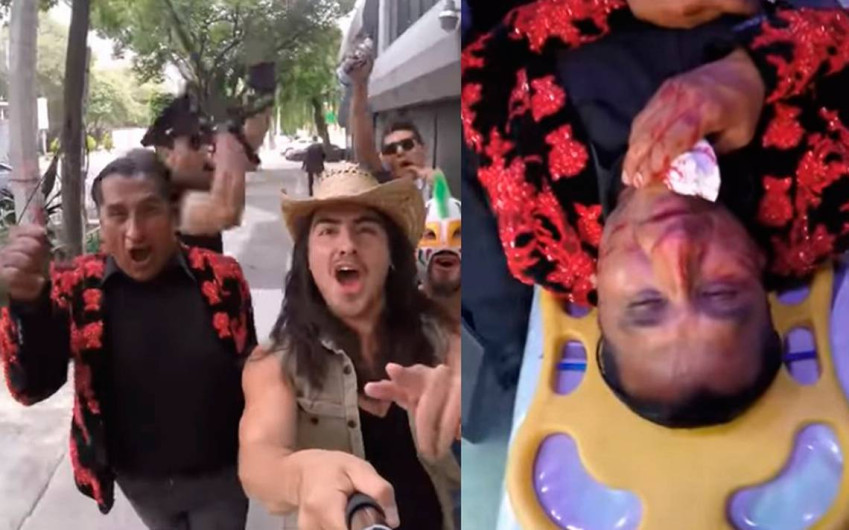 ¡Al hospital! Lady wuuu resulta con nariz rota tras broma