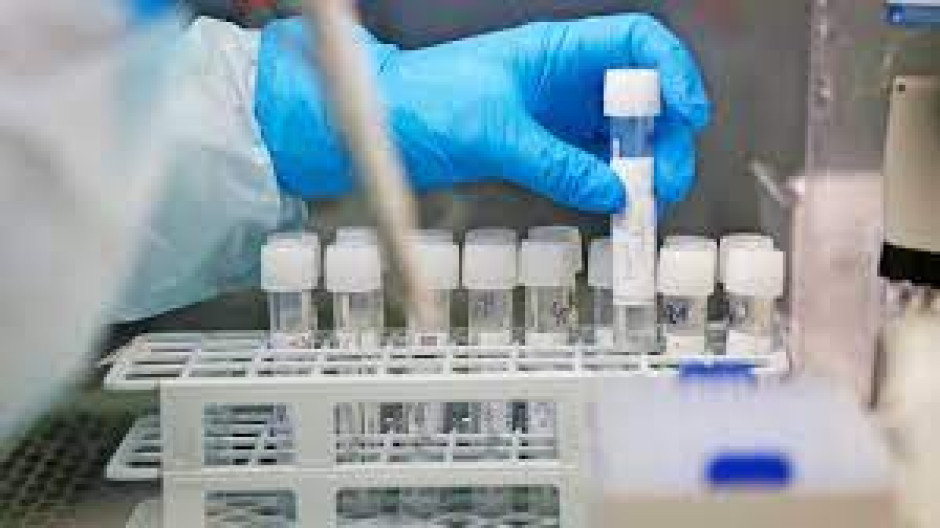 Detectan primer caso de hepatitis grave de origen desconocido en América Latina