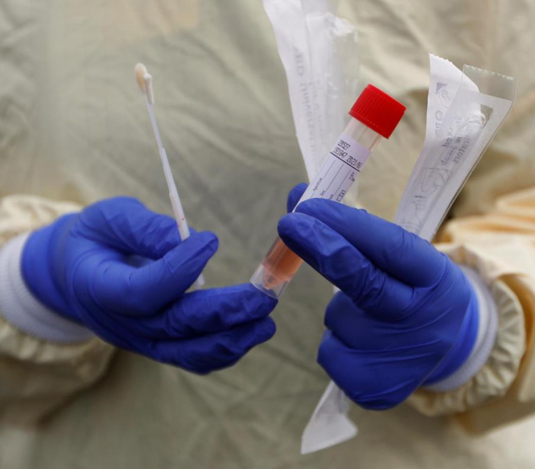 México, el país que realiza menos pruebas de COVID-19 de la OCDE