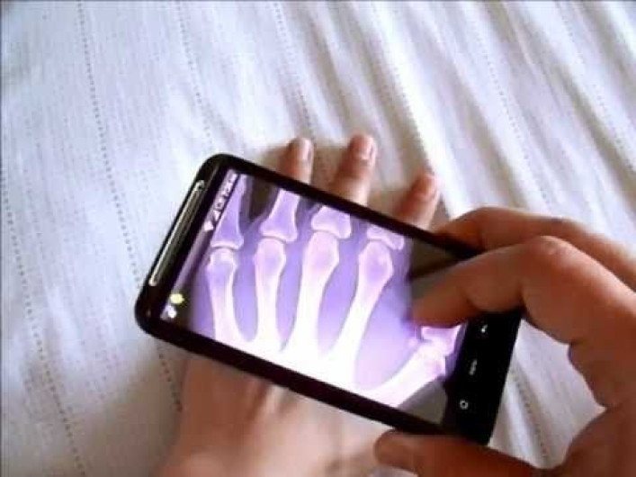 Tecnología permitirá a celulares ver a través de la piel o paredes