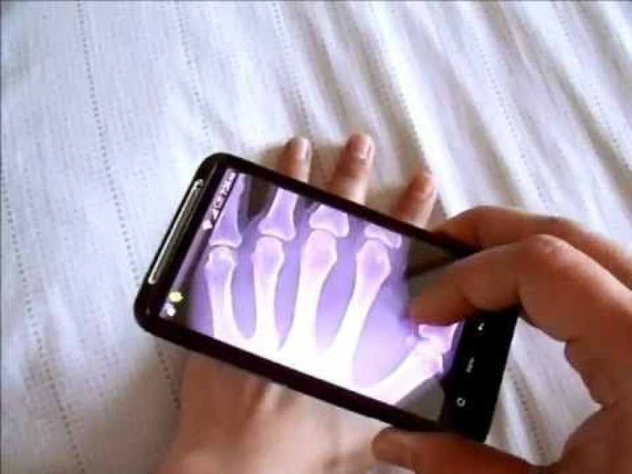 Tecnología permitirá a celulares ver a través de la piel o paredes