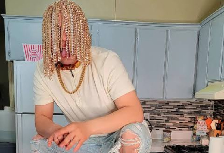 Rapero mexicano se implanta cadenas de oro en lugar de cabello