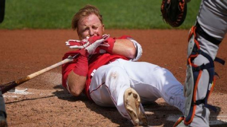 Justin Turner recibió 16 puntos en la cara tras un pelotazo