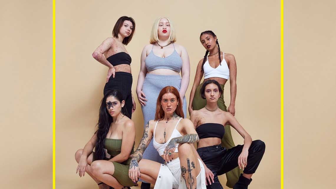 Así celebramos los "defectos" en la piel