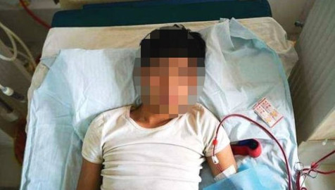 Joven vende riñón para comprar iPhone y ahora vive en cama