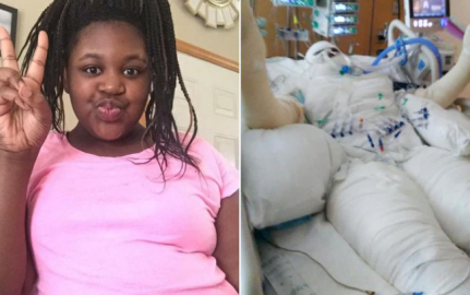 Niña a punto de morir por el #FireChallenge