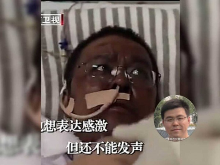 Muere médico en China cuya piel se oscureció a causa del tratamiento