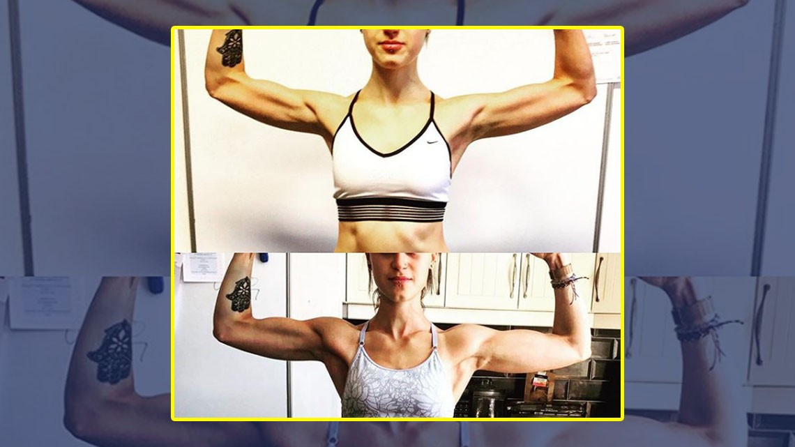 Chica muestra su recuperación tras anorexia