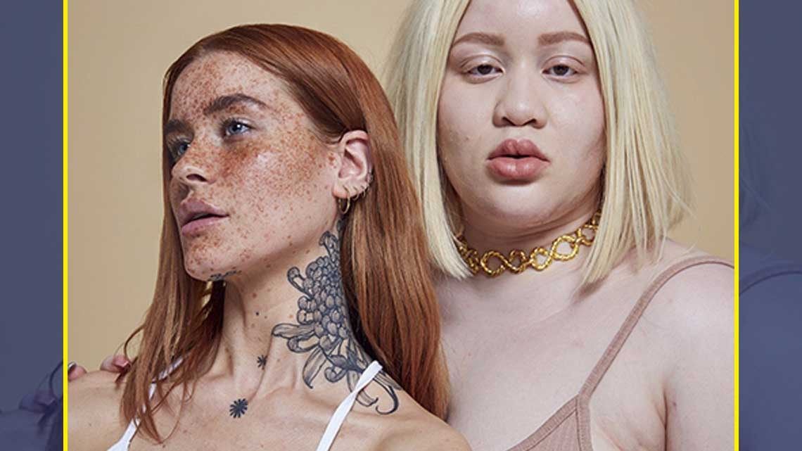 Así celebramos los "defectos" en la piel