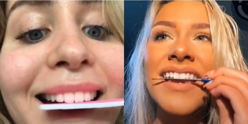 Limarse los dientes: la nueva ‘tendencia’ en Tik-Tok