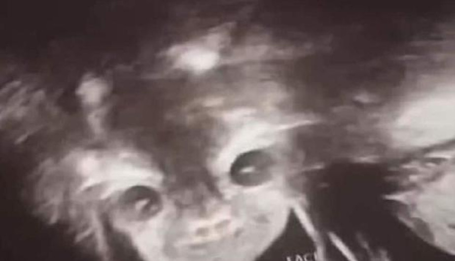 ¡Ay, nanita! captan inquietante rostro el ultrasonido