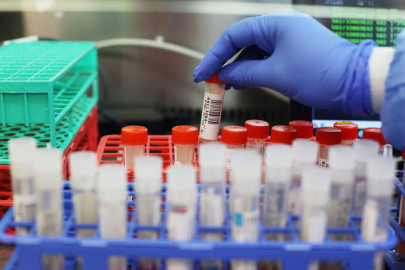 Texas confirma su primer caso de Ómicron, es en Houston