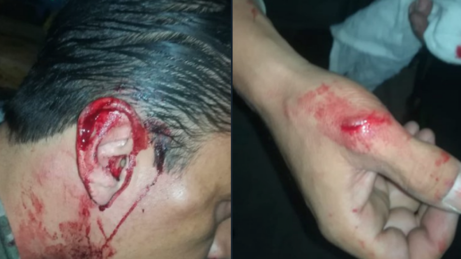 Agreden a reportero y camarógrafo de Multimedios