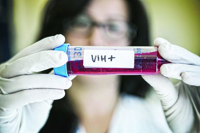 Confirman el segundo caso en el mundo de paciente curado de VIH