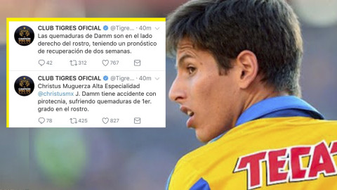 Jürgen Damm sufrió un accidente con pirotecnia