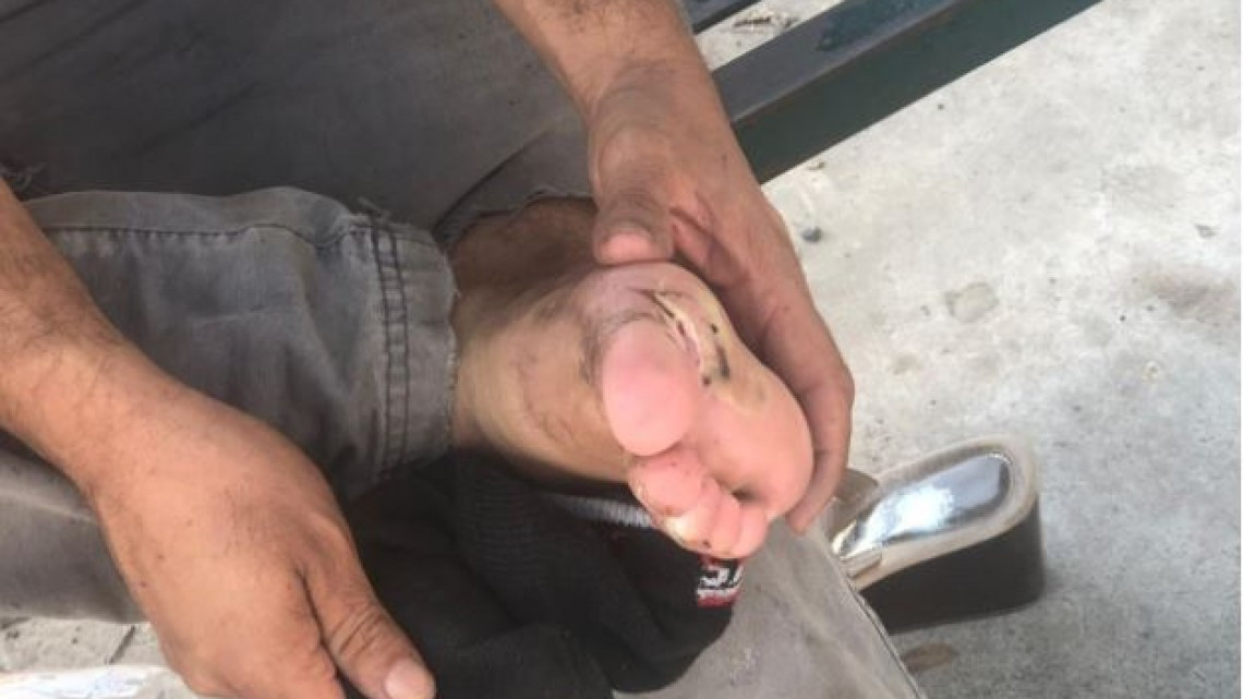 Migrante llega a Reynosa con heridas tras 60 horas de caminata 