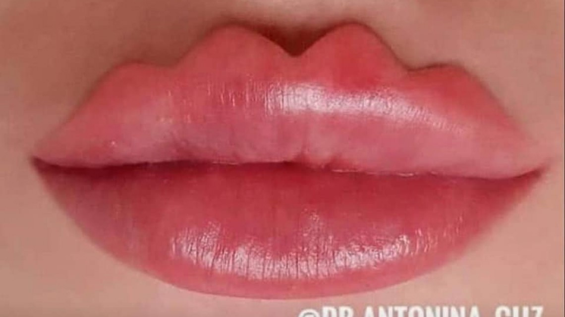 ¿Te atreverías a hacértelos? Llegan los “labios del diablo”, la nueva moda en redes