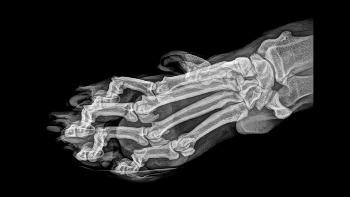 Estas radiografías te dejarán helado