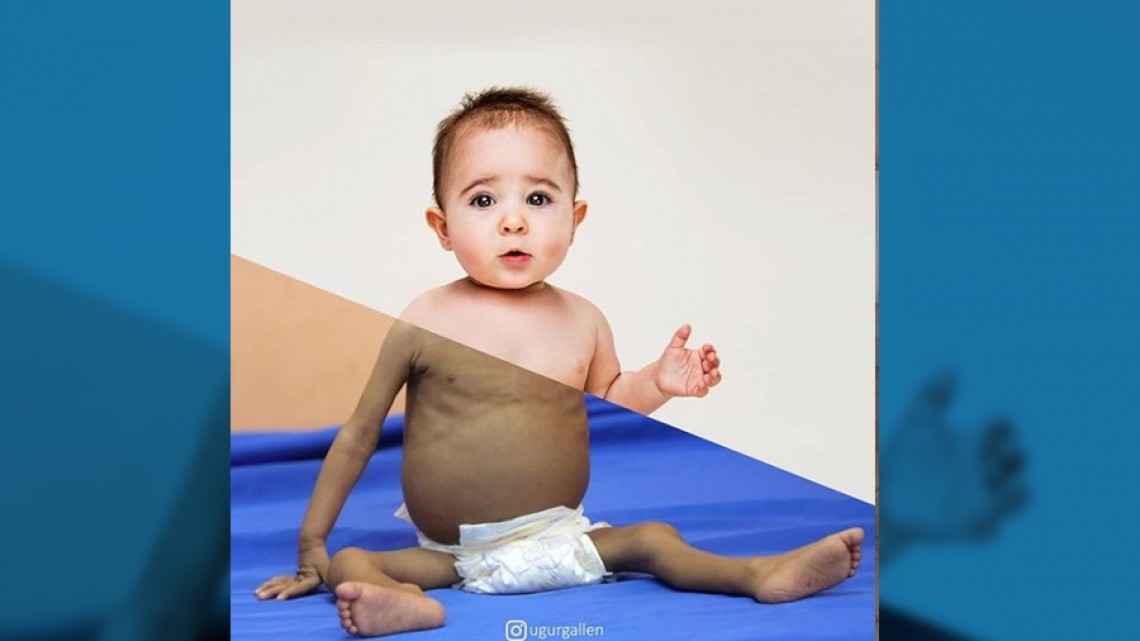 Impresionantes collages fotográficos muestran contrastes sociales en Instagram