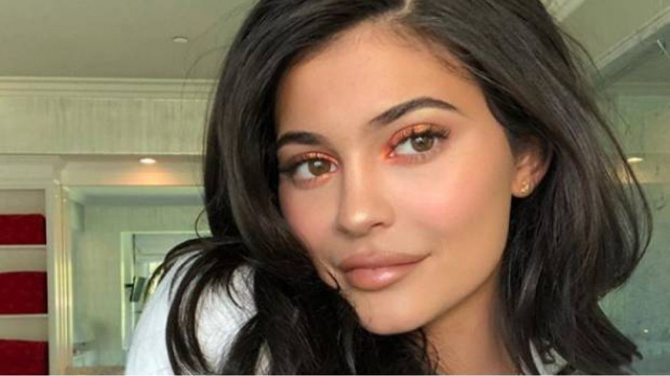 Kylie Jenner se quita el relleno de los labios
