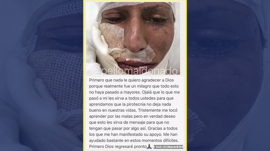 Jürgen Damm sufrió un accidente con pirotecnia