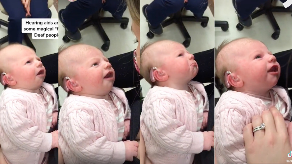 Bebé con discapacidad auditiva conmueve en TikTok al escuchar la voz de su mamá