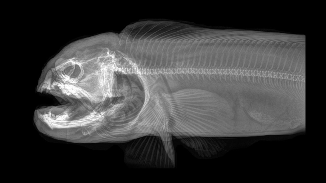 Estas radiografías te dejarán helado