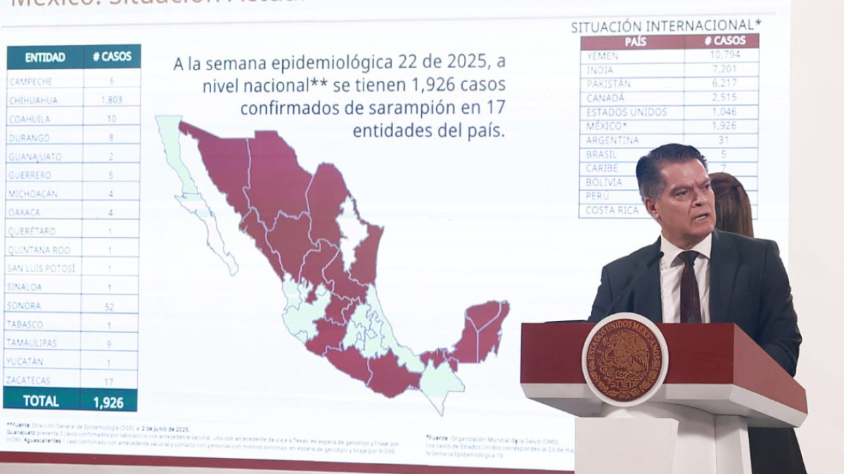 México registra 1,926 casos de sarampión en 17 estados; hay 9 en Tamaulipas