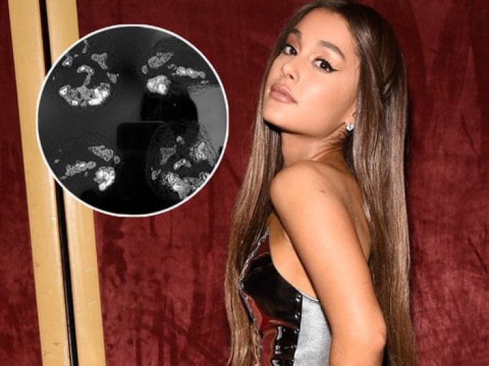 Ariana muestra su daño cerebral