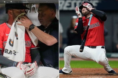 David Fry sufre fracturas faciales tras brutal pelotazo en la MLB