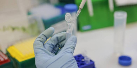 CDC recuerdan, vacunas de refuerzo aún no están disponibles para todos