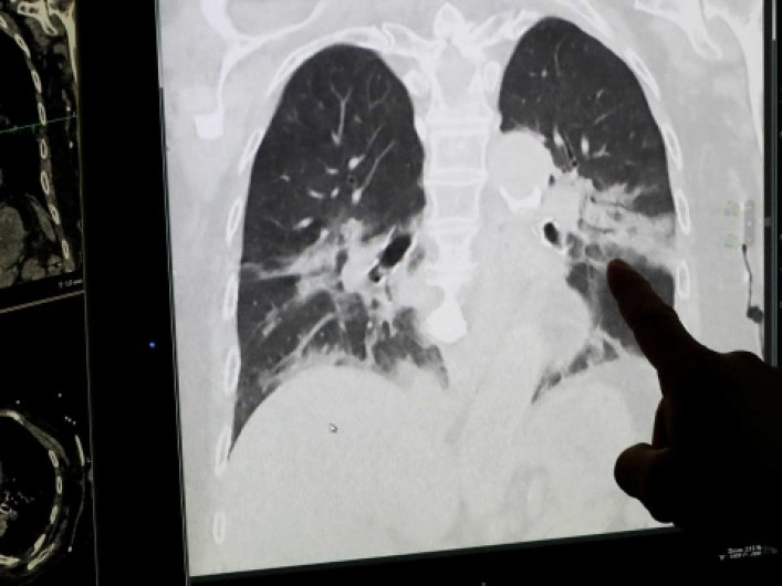 Tenemos mucho camino por delante: OMS