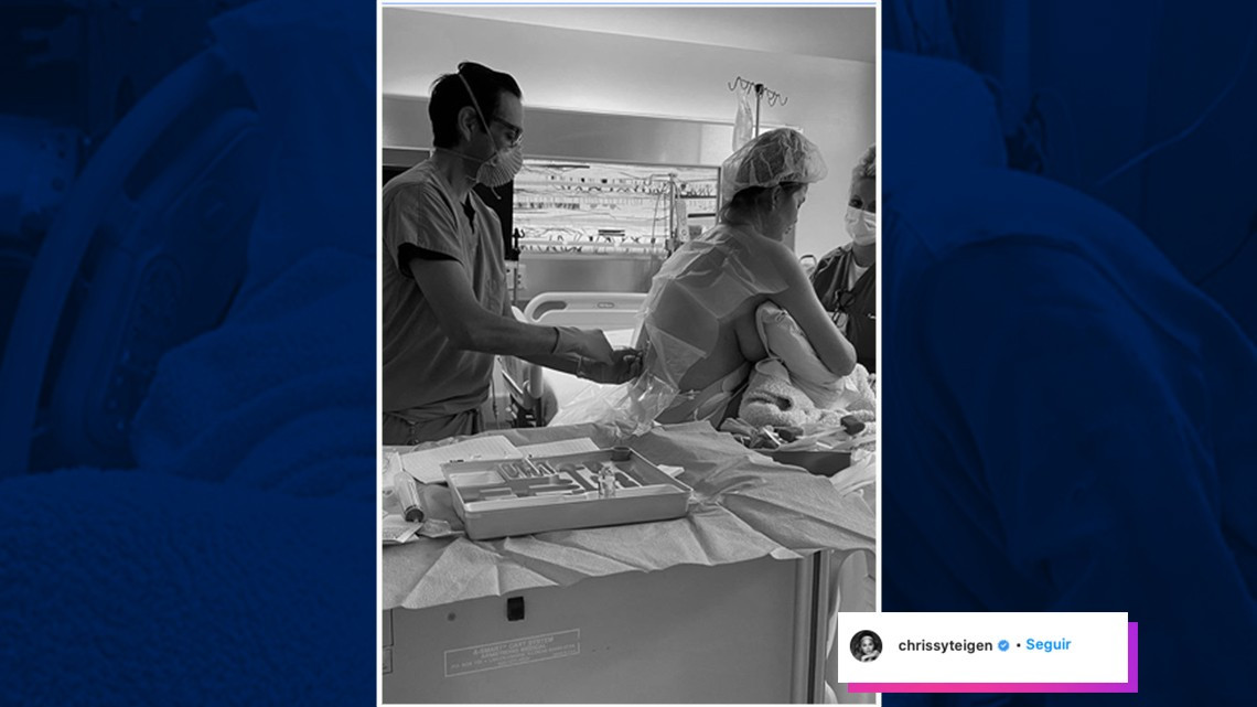 El mensaje de Chrissy Teigen y John Legend tras perder a su bebé