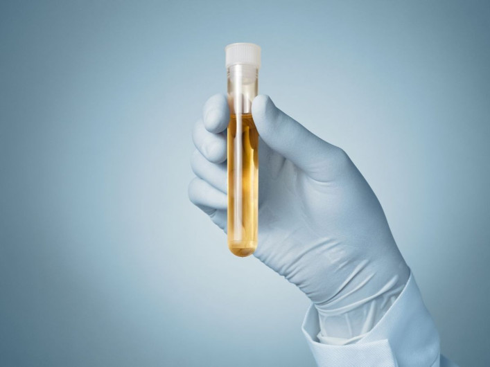 Crean compuesto para el rápido diagnóstico de problemas de tiroides