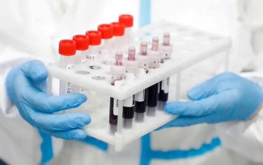 Se eleva a 408 mil fallecidos por covid-19 en el mundo 