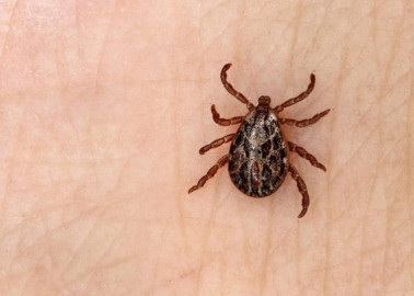 Confirman en Nuevo León muerte de dos menores por la picadura de una garrapata