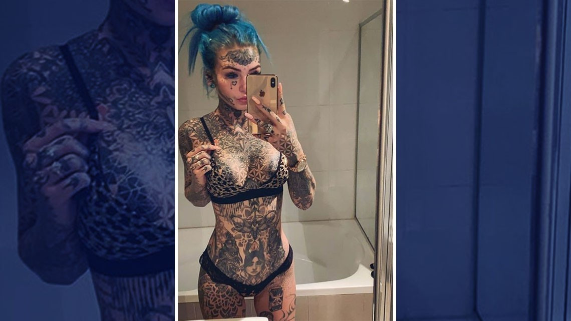 Por procedimiento fallido quedó ciega por 3 semanas